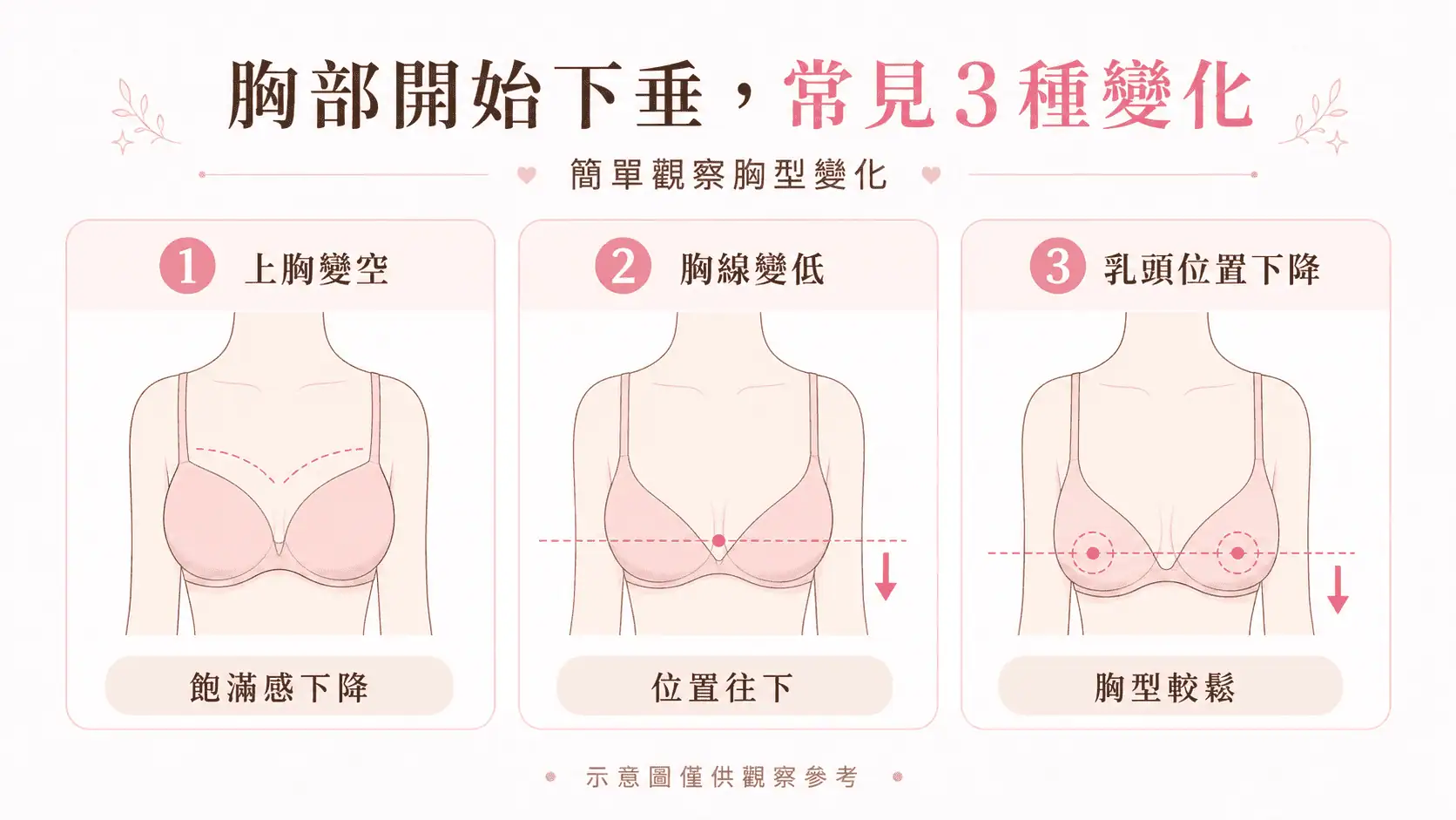 布袋奶, 垂奶, 下垂奶, 胸部老化